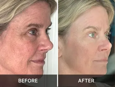 Total Package Serum firmer-looking facial skin comparison